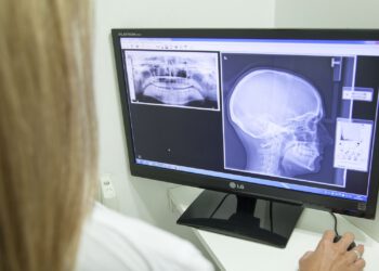 This AI diagnoses cancer better than 15 doctors in a competition