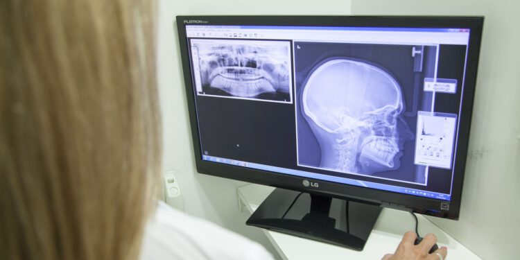 This AI diagnoses cancer better than 15 doctors in a competition