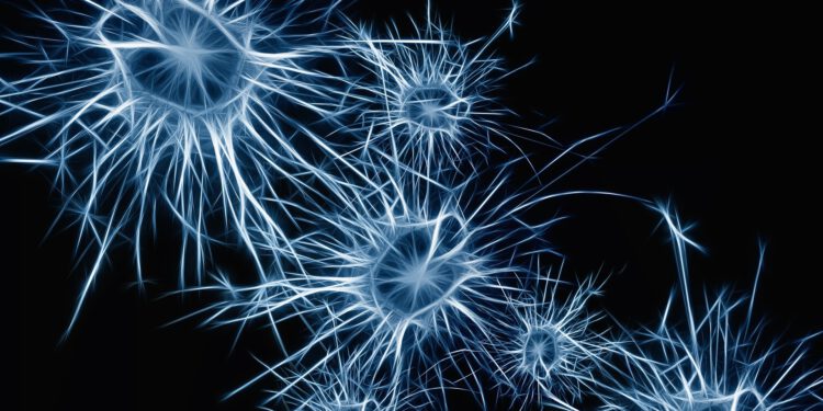 This AI system can diagnose Alzheimer's 10 years in advance