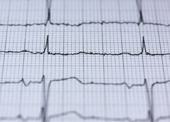 Unlock your computer with your heartbeat, is it possible?