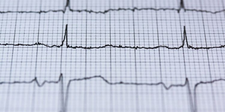 Unlock your computer with your heartbeat, is it possible?